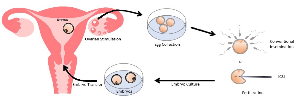 in vitro fertilization embryos