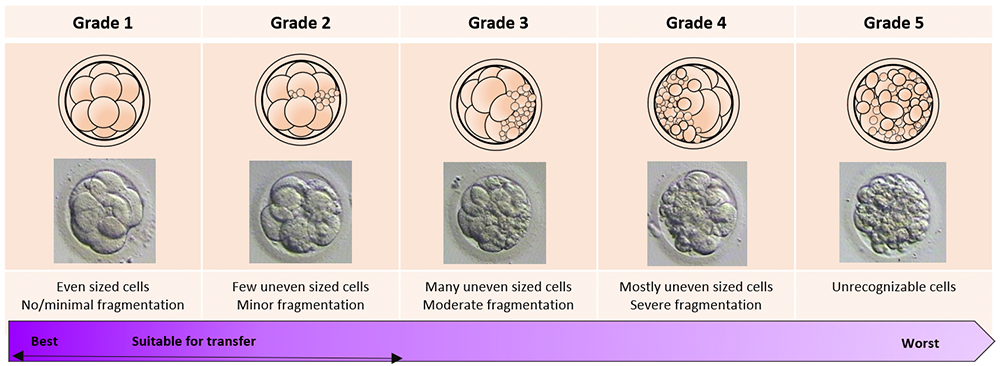 In vitro Fertilization