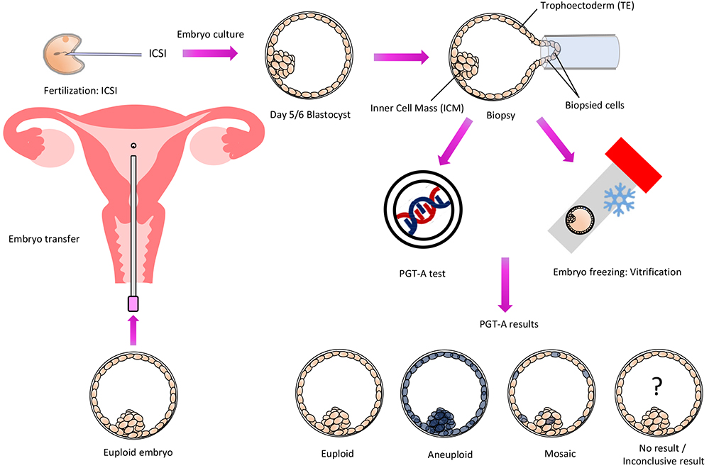 pre-implantation-genetic-testing-for-aneuploidies-pgt-a